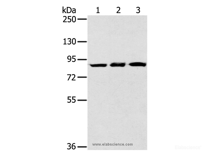 Western Blot analysis of Human bladder carcinoma tissue, Mouse liver and Human fetal liver tissue using SYTL5 Polyclonal Antibody at dilution of 1:400