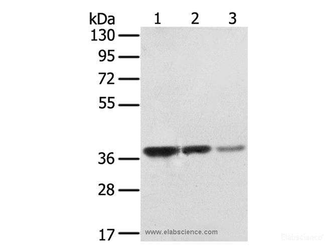 Western Blot analysis of MCF7, A172 and hepg2 cell using STX16 Polyclonal Antibody at dilution of 1:400