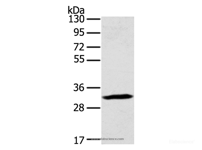 Western Blot analysis of Mouse lung tissue using STX11 Polyclonal Antibody at dilution of 1:400