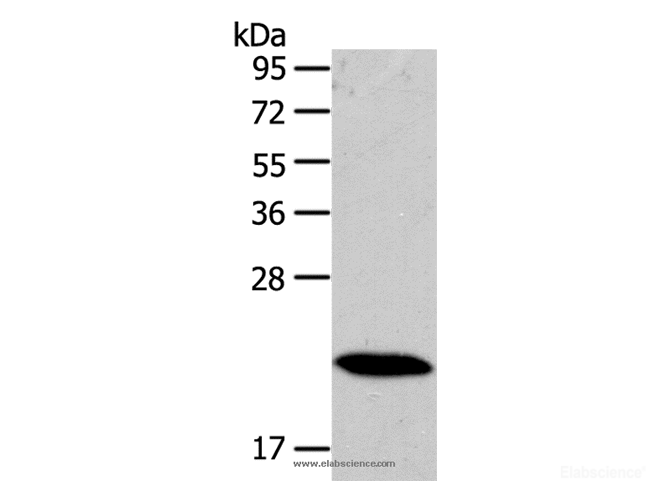Western Blot analysis of Mouse heart tissue using RAB18 Polyclonal Antibody at dilution of 1:400
