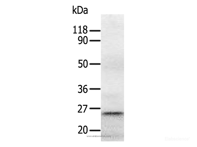 Western Blot analysis of Human fetal brain tissue using RAB5A Polyclonal Antibody at dilution of 1:1300