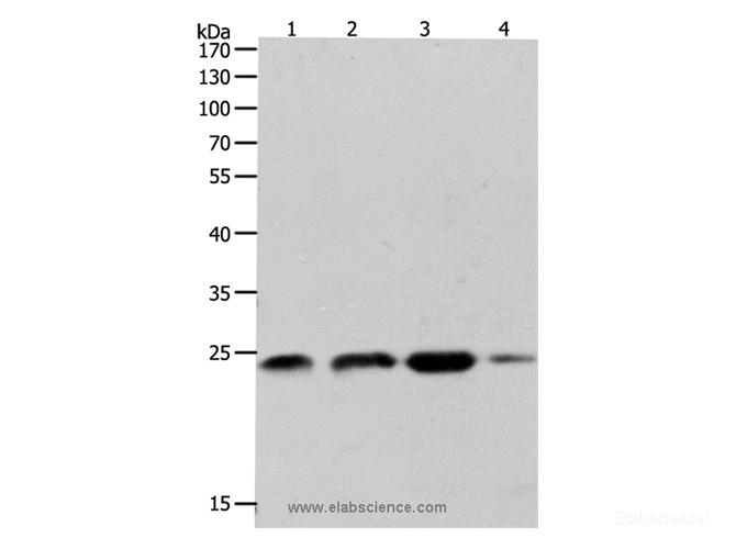 Western Blot analysis of K562, 231 and Hela cell, Human fetal brain tissue using RHOA Polyclonal Antibody at dilution of 1:400