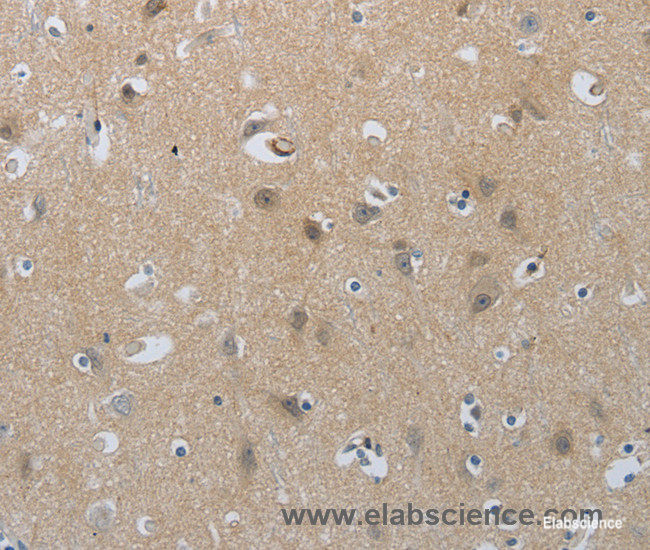 Immunohistochemistry of paraffin-embedded Human brain tissue using NPR1 Polyclonal Antibody at dilution of 1:30