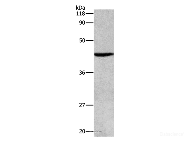 Western Blot analysis of Hela cell using ATG4B Polyclonal Antibody at dilution of 1:500