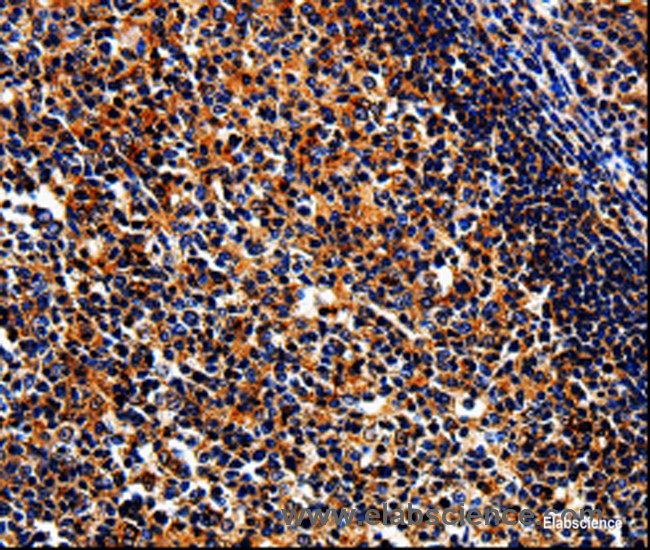 Immunohistochemistry of paraffin-embedded Human tonsil tissue using BIRC6 Polyclonal Antibody at dilution 1:50