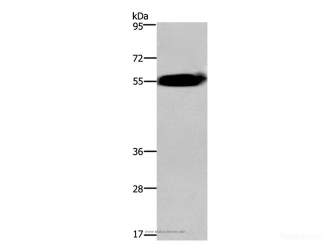 Western Blot analysis of Human fetal brain tissue using ACVR2A Polyclonal Antibody at dilution of 1:400