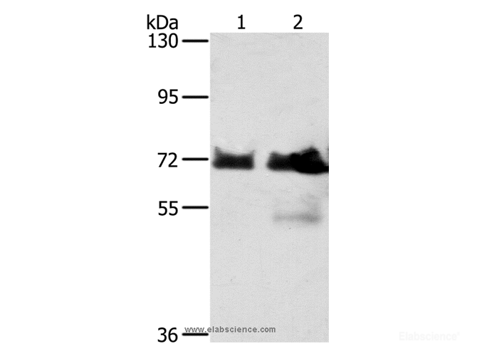 Western Blot analysis of Hela and Raji cell using BRAF Polyclonal Antibody at dilution of 1:400
