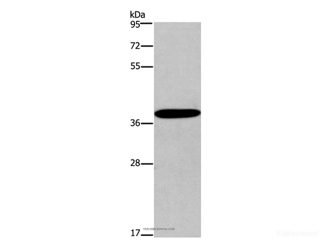 Western Blot analysis of Mouse skin tissue using CD192 Polyclonal Antibody at dilution of 1:450