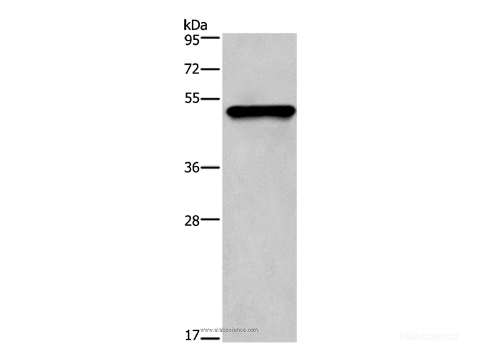 Western Blot analysis of Mouse skin tissue using CK-14 Polyclonal Antibody at dilution of 1:1350