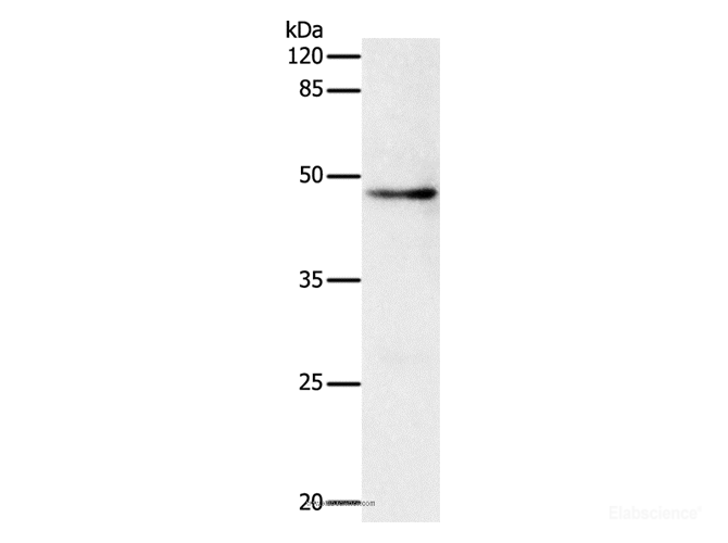 Western Blot analysis of Hela cell using DRD1 Polyclonal Antibody at dilution of 1:500