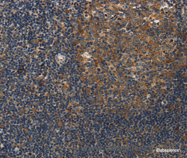 Immunohistochemistry of paraffin-embedded Human tonsil tissue using DSP Polyclonal Antibody at dilution 1:40
