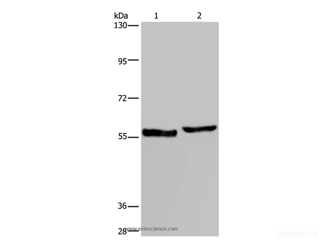 Western Blot analysis of Human testis tissue and A375 cell using SLC1A6 Polyclonal Antibody at dilution of 1:400