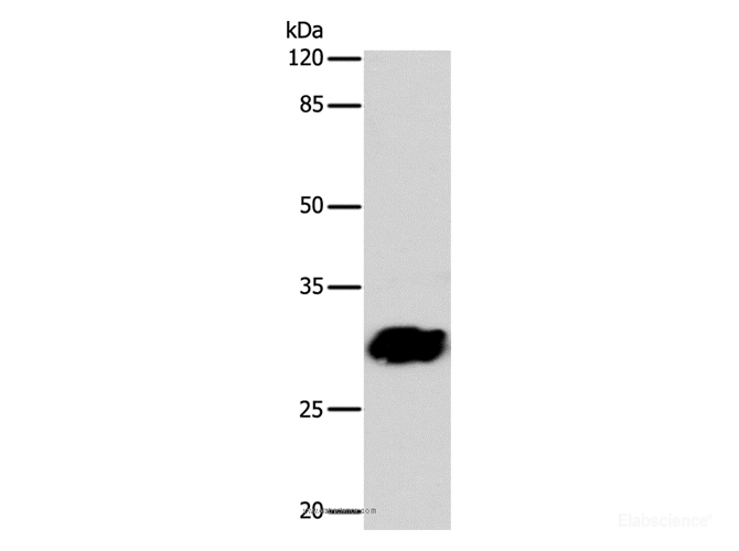 Western Blot analysis of 293T cell using GJB6 Polyclonal Antibody at dilution of 1:1040