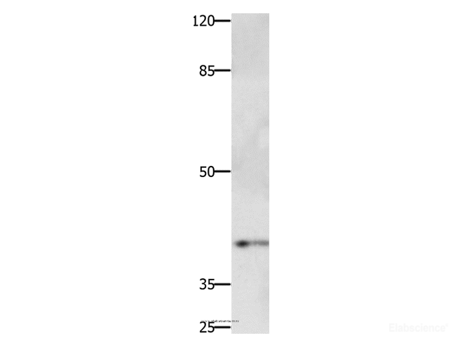 Western Blot analysis of Jurkat cell using PTGER1 Polyclonal Antibody at dilution of 1:500