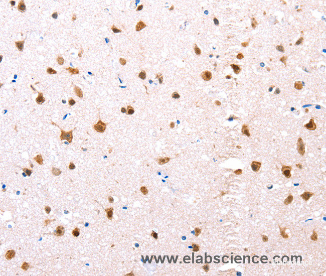 Immunohistochemistry of paraffin-embedded Human brain tissue using ER alpha Polyclonal Antibody at dilution 1:76