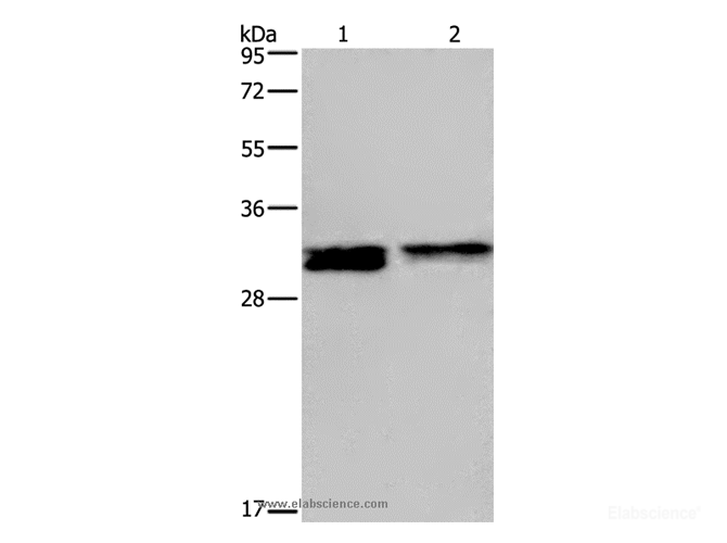 Western Blot analysis of Hela and Jurkat cell using FOSL1 Polyclonal Antibody at dilution of 1:615