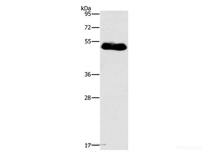 Western Blot analysis of Human placenta tissue using FOXF2 Polyclonal Antibody at dilution of 1:733
