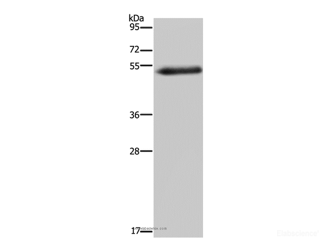 Western Blot analysis of Human breast infiltRative duct tissue using FOXC2 Polyclonal Antibody at dilution of 1:733