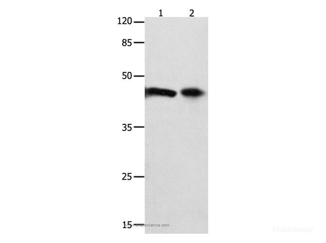 Western Blot analysis of 293T cell and Mouse intestinum tenue tissue   using FOXL1  Polyclonal Antibody at dilution of 1:850