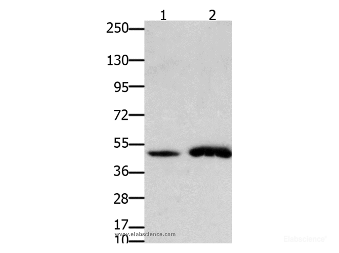 Western Blot analysis of Mouse brain and  heart tissue using FOXL2 Polyclonal Antibody at dilution of 1:750