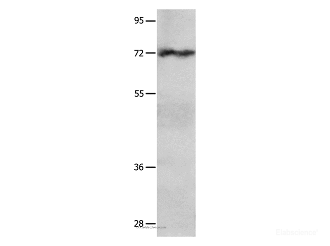 Western Blot analysis of Hela cell   using IGF2BP1 Polyclonal Antibody at dilution of 1:750