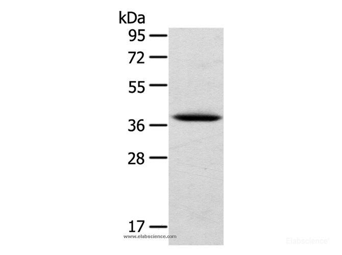 Western Blot analysis of Human cervical cancer tissue using TPM2 Polyclonal Antibody at dilution of 1:750