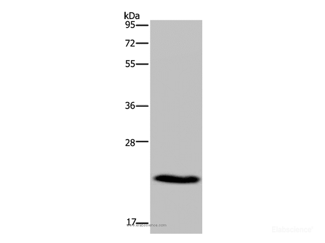 Western Blot analysis of Mouse heart tissue using CMTM5 Polyclonal Antibody at dilution of 1:400