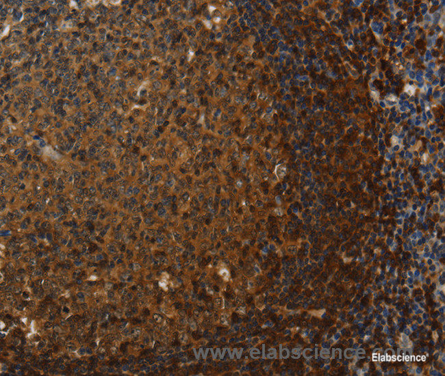 Immunohistochemistry of paraffin-embedded Human tonsil tissue using Claudin 8 Polyclonal Antibody at dilution 1:50