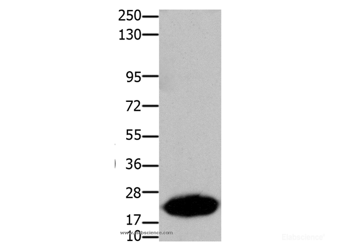 Western Blot analysis of Human liver cancer tissue using Claudin 7 Polyclonal Antibody at dilution of 1:1050