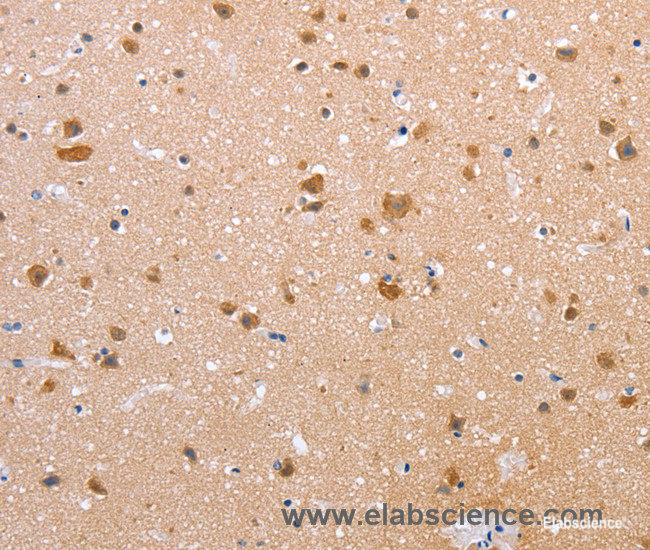 Immunohistochemistry of paraffin-embedded Human brain tissue using Claudin 10 Polyclonal Antibody at dilution 1:50