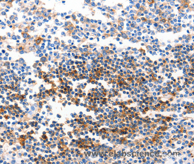 Immunohistochemistry of paraffin-embedded Human tonsil tissue using GJB6 Polyclonal Antibody at dilution 1:40