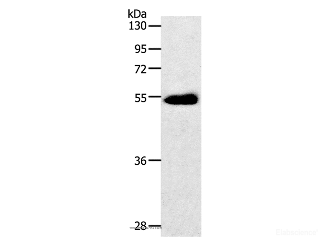 Western Blot analysis of Human colon cancer tissue using GLUT-3 Polyclonal Antibody at dilution of 1:400