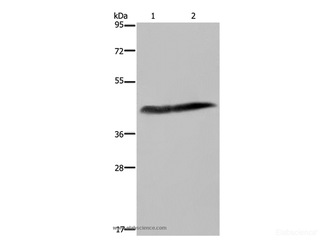 Western Blot analysis of Human placenta tissue and HepG2 cell using CD116 Polyclonal Antibody at dilution of 1:250