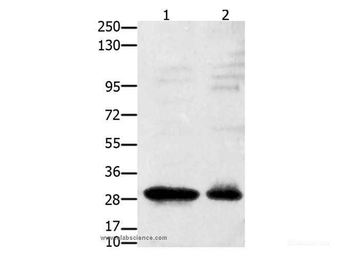 Western Blot analysis of 231 cell and Mouse testis tissue using GNRHR Polyclonal Antibody at dilution of 1:2350