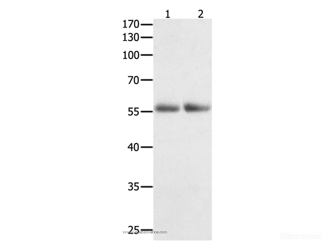 Western Blot analysis of Human colon  and  kidney cancer tissue   using HDAC1 Polyclonal Antibody at dilution of 1:400