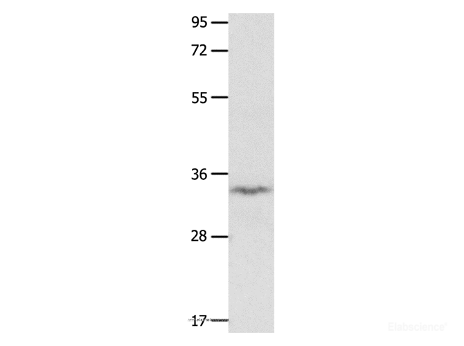 Western Blot analysis of Mouse brain tissue using IGFBP7 Polyclonal Antibody at dilution of 1:400