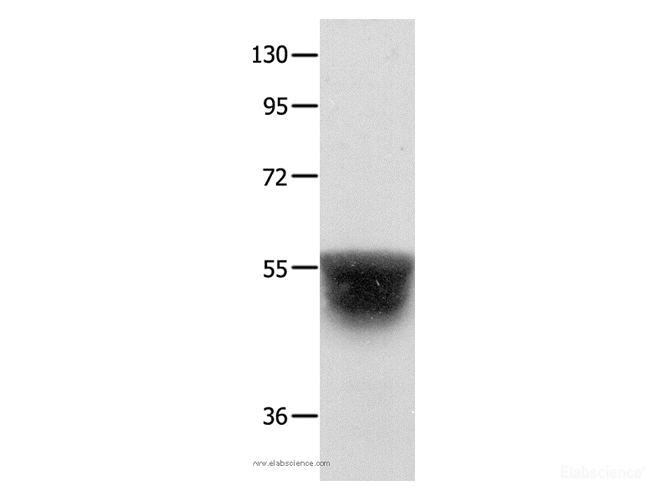 Western Blot analysis of Human brain malignant glioma tissue   using KCNA1 Polyclonal Antibody at dilution of 1:400