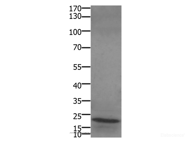 Western Blot analysis of Human liver cancer tissue using STMN2/3/4 Polyclonal Antibody at dilution of 1:450