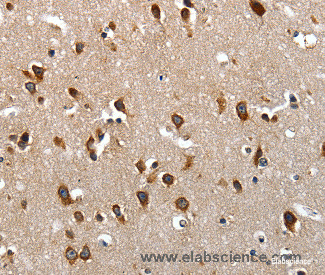 Immunohistochemistry of paraffin-embedded Human brain tissue using LAMA1 Polyclonal Antibody at dilution of 1:70