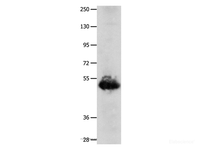 Western Blot analysis of Human lung cancer tissue   using BPIFB3 Polyclonal Antibody at dilution of 1:1600