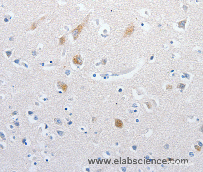 Immunohistochemistry of paraffin-embedded Human brain tissue using MATN1 Polyclonal Antibody at dilution 1:60