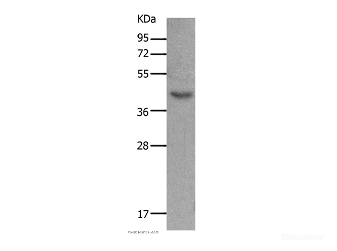 Western Blot analysis of Mouse muscle tissue using MC5R Polyclonal Antibody at dilution of 1:1200