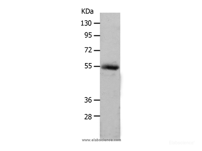 Western Blot analysis of Human colon cancer tissue using MMP17 Polyclonal Antibody at dilution of 1:550
