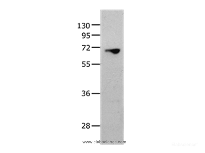 Western Blot analysis of 823 cell using MMP25 Polyclonal Antibody at dilution of 1:1300