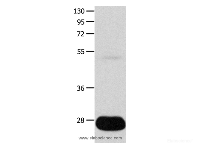 Western Blot analysis of Human liver cancer tissue   using POMC Polyclonal Antibody at dilution of 1:450
