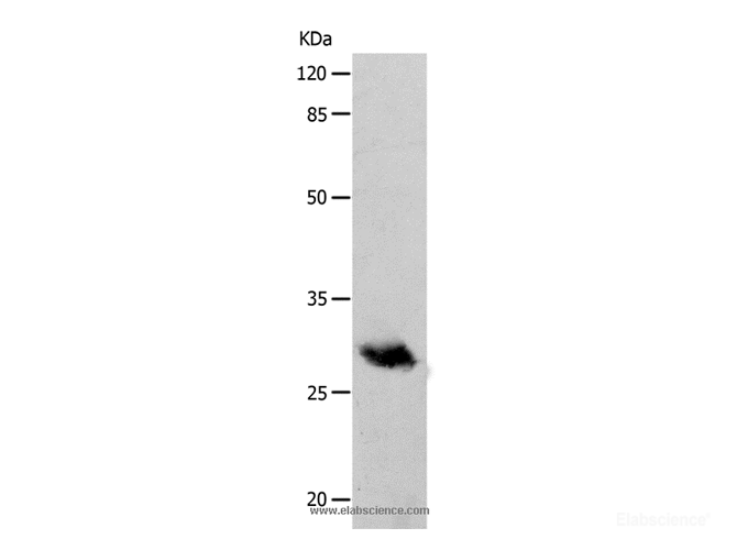 Western Blot analysis of Human fetal brain tissue using POMC Polyclonal Antibody at dilution of 1:400