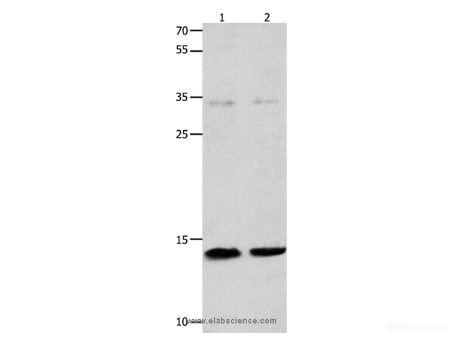 Western Blot analysis of Jurkat and 231 cell   using MYL9 Polyclonal Antibody at dilution of 1:1500