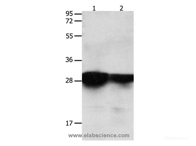 Western Blot analysis of Human brain malignant glioma and laryngocarcinoma tissue using 14-3-3 epsilon Polyclonal Antibody at dilution of 1:2200