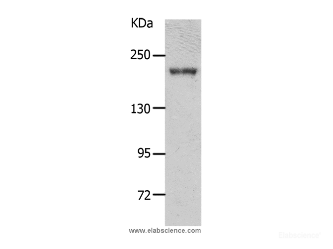 Western Blot analysis of Mouse kidney tissue using NPHS1 Polyclonal Antibody at dilution of 1:700