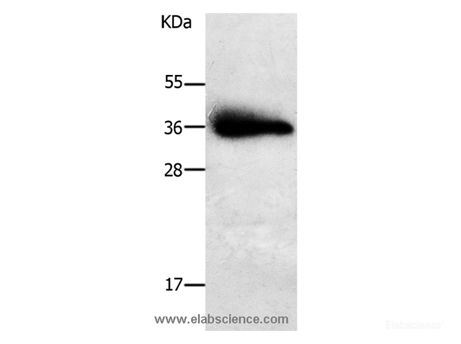 Western Blot analysis of Human liver cancer tissue using PLPP1 Polyclonal Antibody at dilution of 1:650